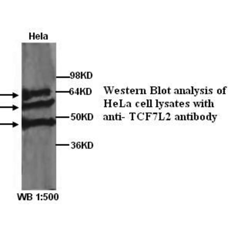 TCF7L2 Antibody from Signalway Antibody (39284) - Antibodies.com