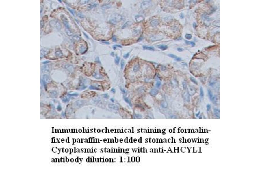 AHCYL1 Antibody from Signalway Antibody (39348) - Antibodies.com
