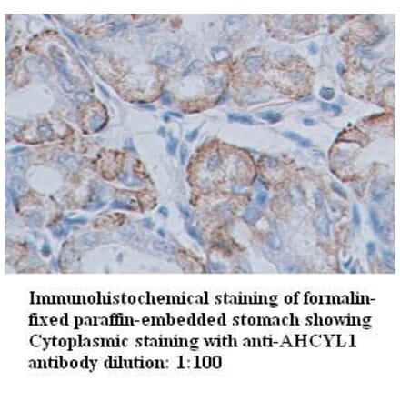 AHCYL1 Antibody from Signalway Antibody (39348) - Antibodies.com