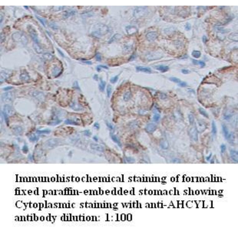 AHCYL1 Antibody from Signalway Antibody (39348) - Antibodies.com