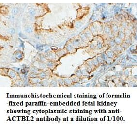 ACTBL2 Antibody from Signalway Antibody (39434) - Antibodies.com