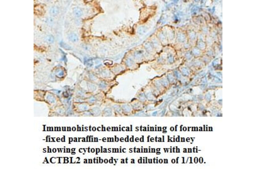 ACTBL2 Antibody from Signalway Antibody (39434) - Antibodies.com