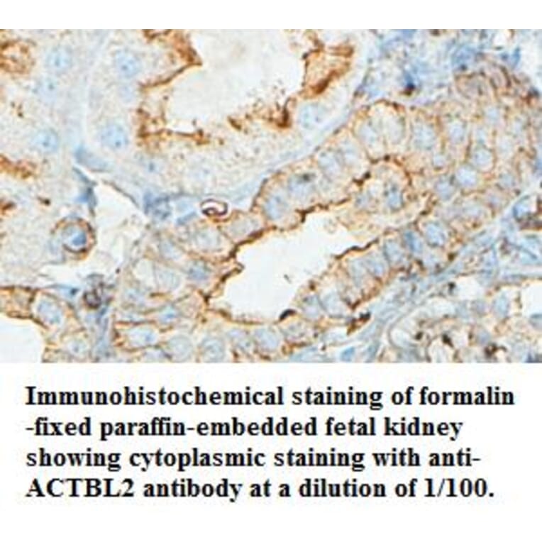 ACTBL2 Antibody from Signalway Antibody (39434) - Antibodies.com