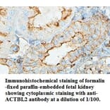 ACTBL2 Antibody from Signalway Antibody (39434) - Antibodies.com