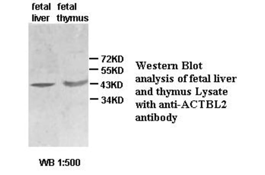 ACTBL2 Antibody from Signalway Antibody (39434) - Antibodies.com