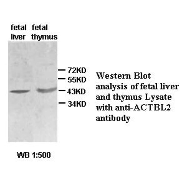 ACTBL2 Antibody from Signalway Antibody (39434) - Antibodies.com