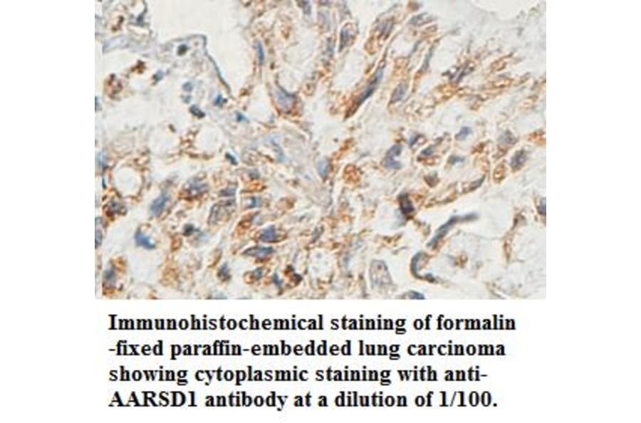 AARSD1 Antibody from Signalway Antibody (39443) - Antibodies.com