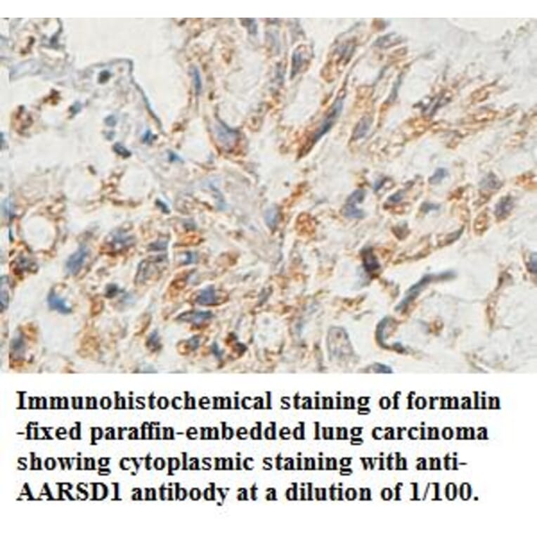 AARSD1 Antibody from Signalway Antibody (39443) - Antibodies.com