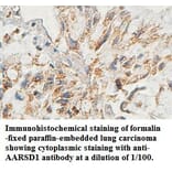 AARSD1 Antibody from Signalway Antibody (39443) - Antibodies.com