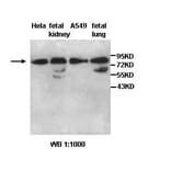 AARSD1 Antibody from Signalway Antibody (39443) - Antibodies.com