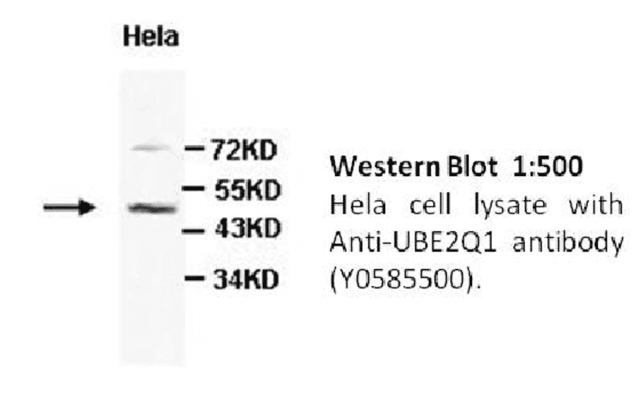 UBE2Q1 Antibody from Signalway Antibody (39450) - Antibodies.com