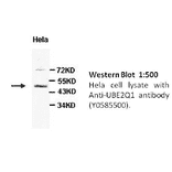 UBE2Q1 Antibody from Signalway Antibody (39450) - Antibodies.com