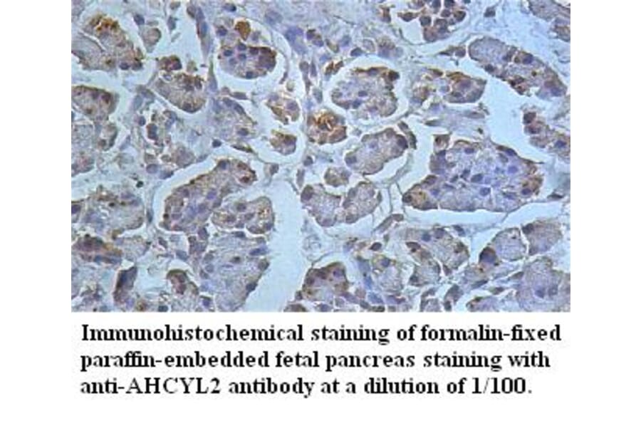 AHCYL2 Antibody from Signalway Antibody (39496) - Antibodies.com