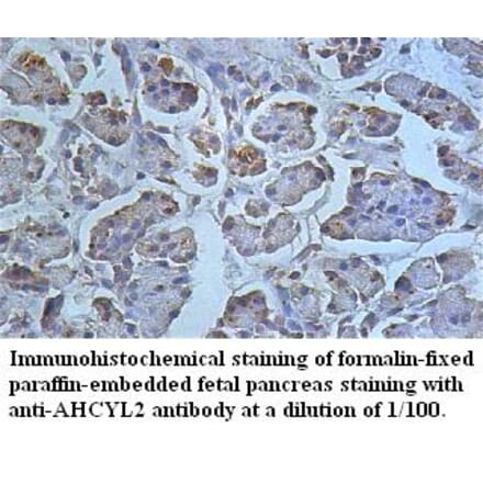 AHCYL2 Antibody from Signalway Antibody (39496) - Antibodies.com