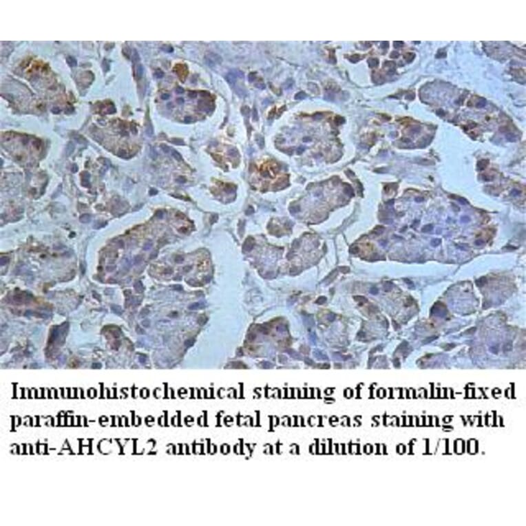 AHCYL2 Antibody from Signalway Antibody (39496) - Antibodies.com