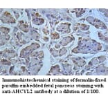 AHCYL2 Antibody from Signalway Antibody (39496) - Antibodies.com