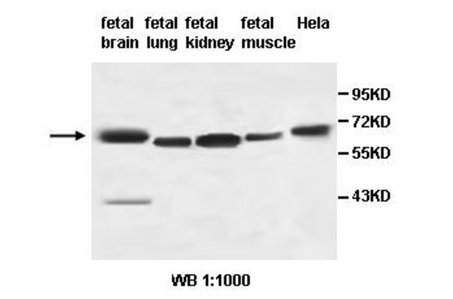 AHCYL2 Antibody from Signalway Antibody (39496) - Antibodies.com