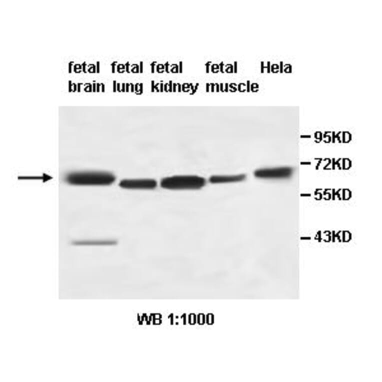 AHCYL2 Antibody from Signalway Antibody (39496) - Antibodies.com