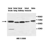 AHCYL2 Antibody from Signalway Antibody (39496) - Antibodies.com
