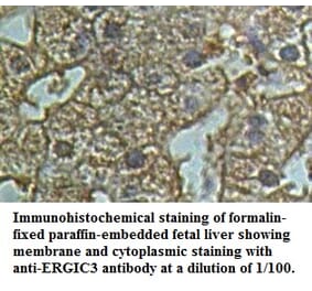 ERGIC3 Antibody from Signalway Antibody (39500) - Antibodies.com