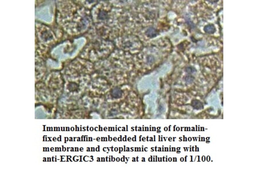 ERGIC3 Antibody from Signalway Antibody (39500) - Antibodies.com