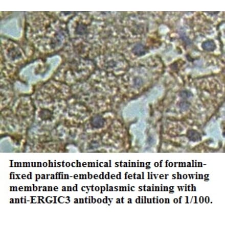 ERGIC3 Antibody from Signalway Antibody (39500) - Antibodies.com