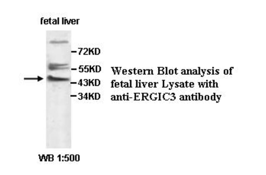 ERGIC3 Antibody from Signalway Antibody (39500) - Antibodies.com