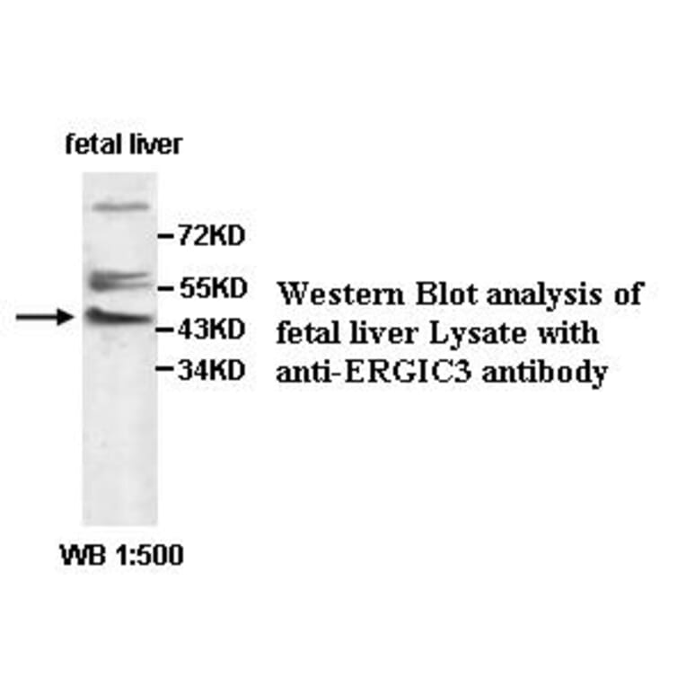 ERGIC3 Antibody from Signalway Antibody (39500) - Antibodies.com