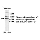 ERGIC3 Antibody from Signalway Antibody (39500) - Antibodies.com