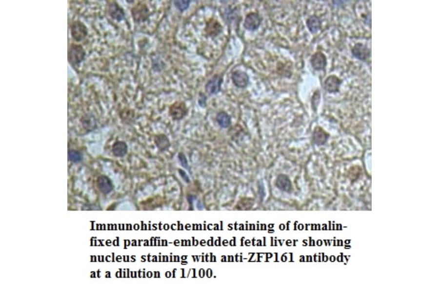ZFP161 Antibody from Signalway Antibody (39501) - Antibodies.com