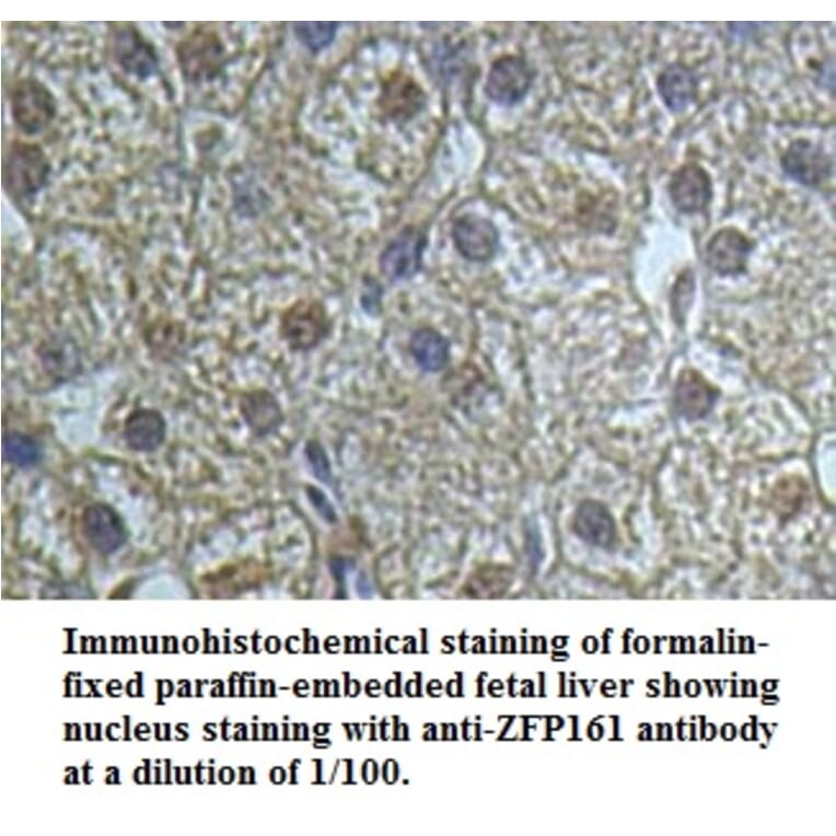 ZFP161 Antibody from Signalway Antibody (39501) - Antibodies.com