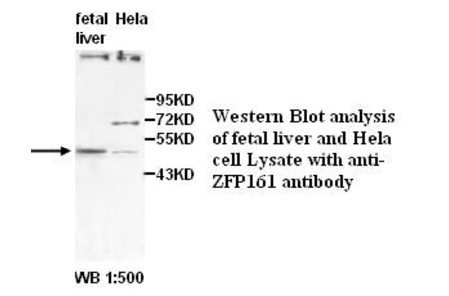 ZFP161 Antibody from Signalway Antibody (39501) - Antibodies.com