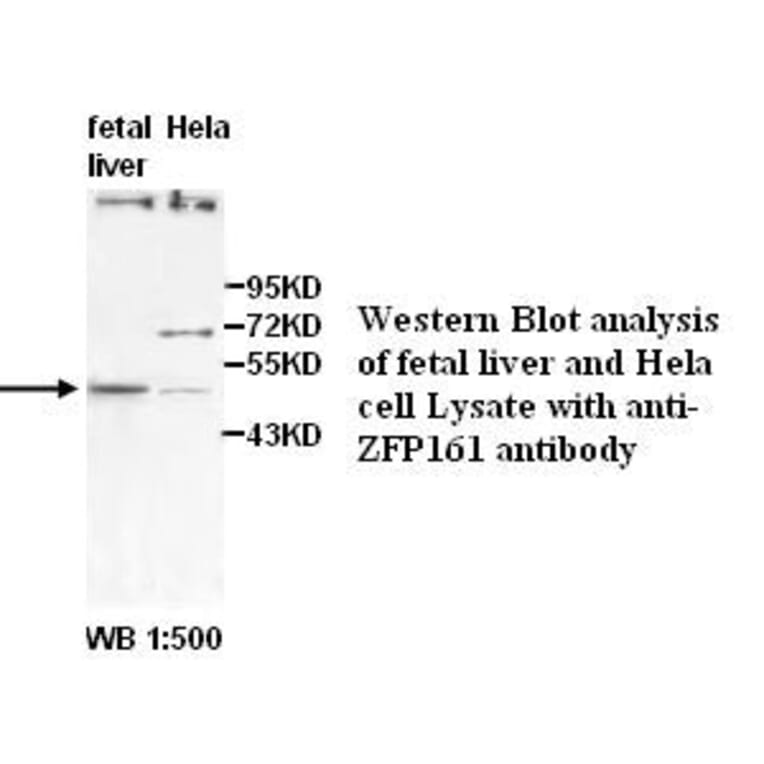 ZFP161 Antibody from Signalway Antibody (39501) - Antibodies.com