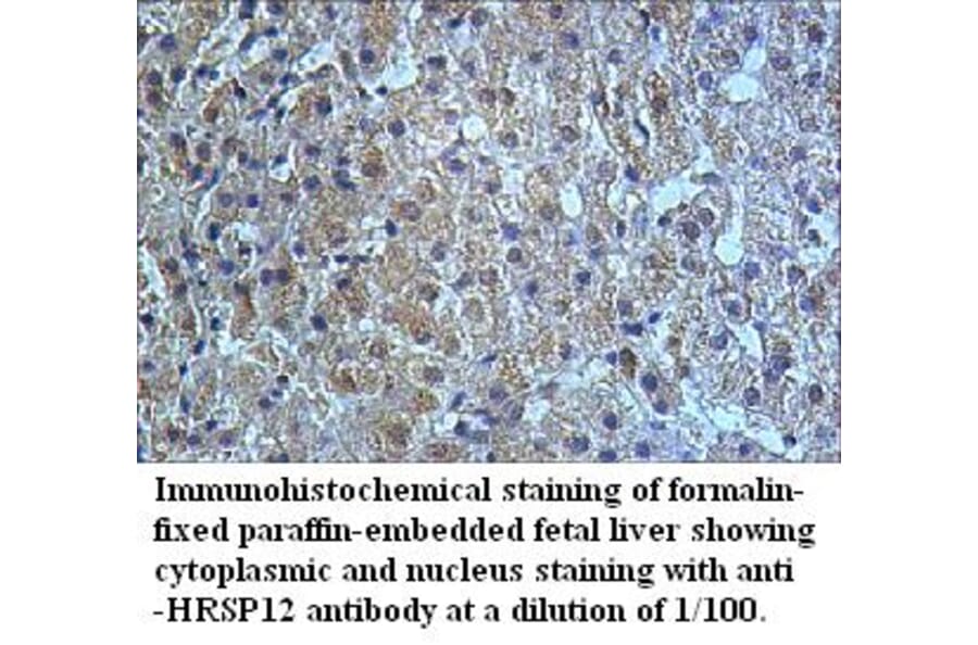 HRSP12 Antibody from Signalway Antibody (39509) - Antibodies.com