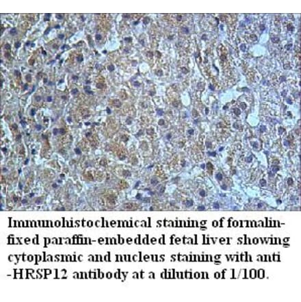 HRSP12 Antibody from Signalway Antibody (39509) - Antibodies.com