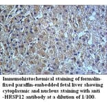 HRSP12 Antibody from Signalway Antibody (39509) - Antibodies.com