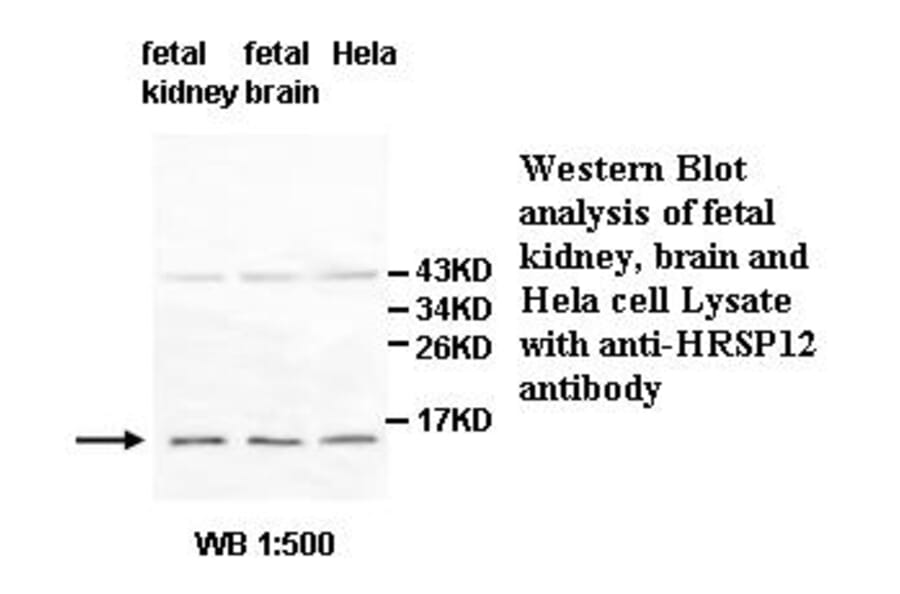 HRSP12 Antibody from Signalway Antibody (39509) - Antibodies.com