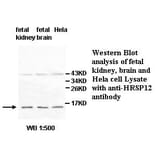 HRSP12 Antibody from Signalway Antibody (39509) - Antibodies.com
