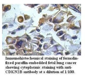 CDKN2B Antibody from Signalway Antibody (39511) - Antibodies.com