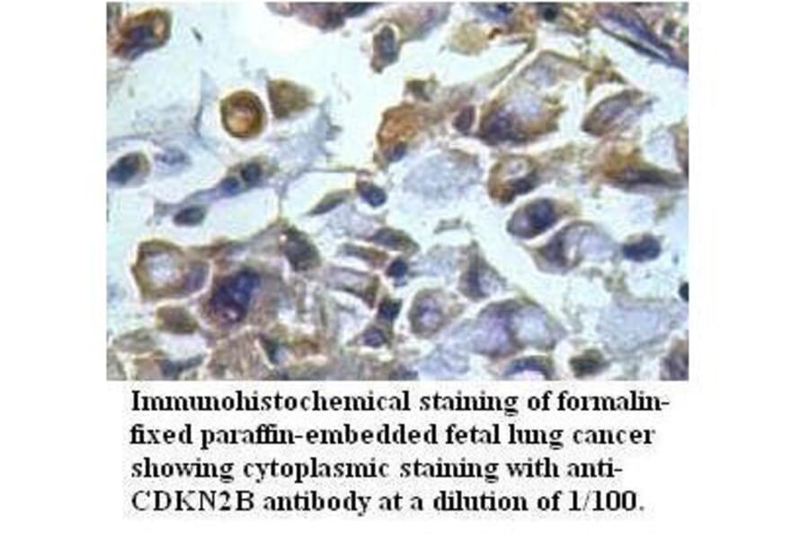CDKN2B Antibody from Signalway Antibody (39511) - Antibodies.com