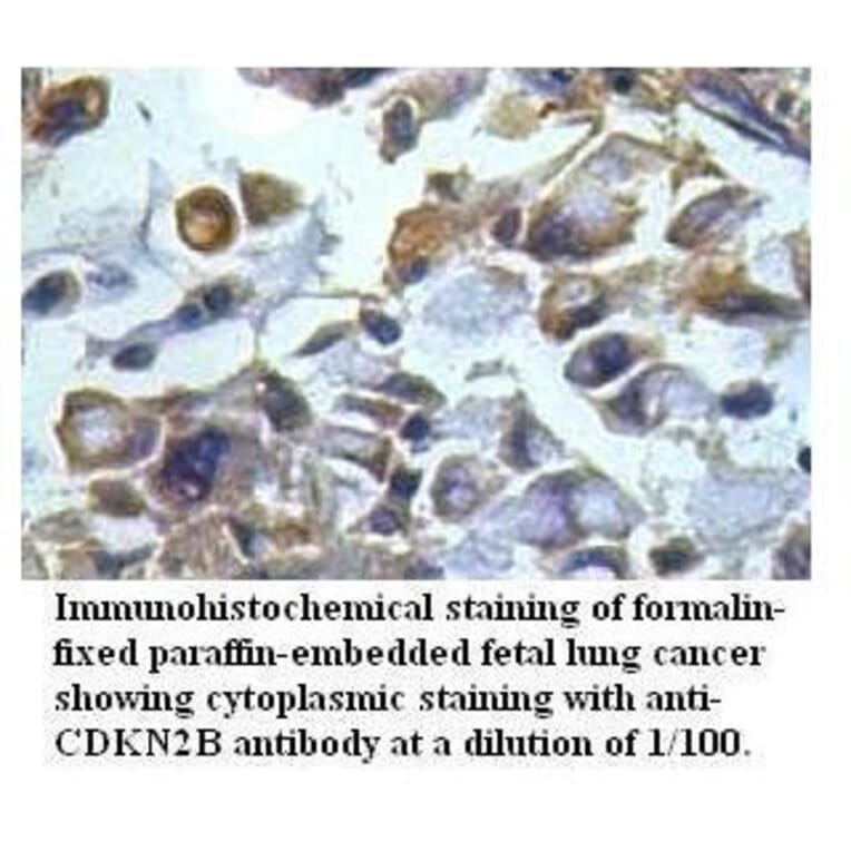 CDKN2B Antibody from Signalway Antibody (39511) - Antibodies.com