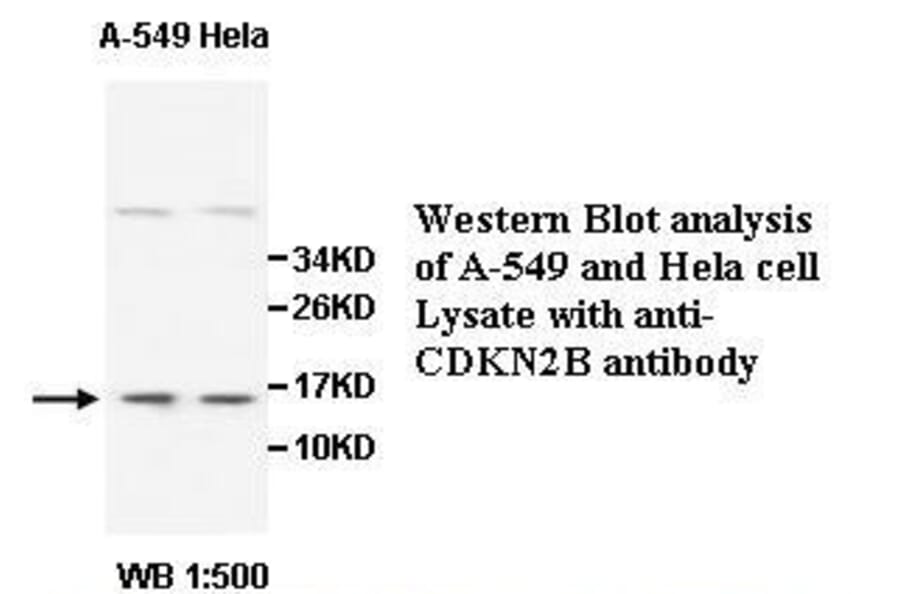 CDKN2B Antibody from Signalway Antibody (39511) - Antibodies.com