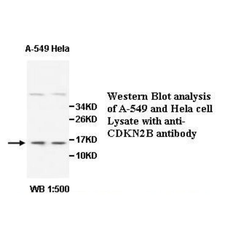 CDKN2B Antibody from Signalway Antibody (39511) - Antibodies.com