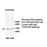 CDKN2B Antibody from Signalway Antibody (39511) - Antibodies.com