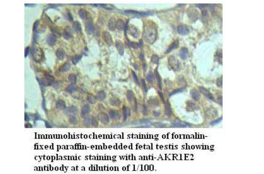 AKR1E2 Antibody from Signalway Antibody (39519) - Antibodies.com