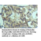 AKR1E2 Antibody from Signalway Antibody (39519) - Antibodies.com