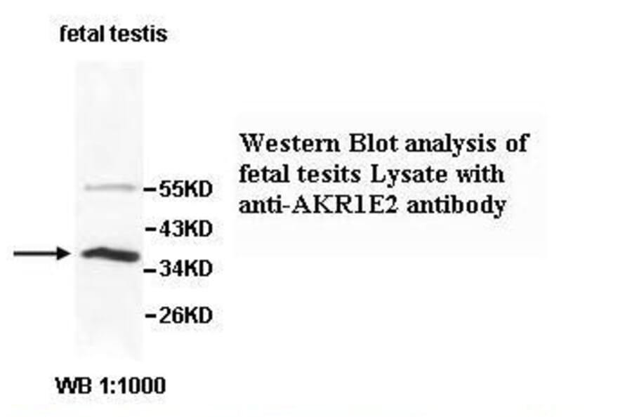 AKR1E2 Antibody from Signalway Antibody (39519) - Antibodies.com