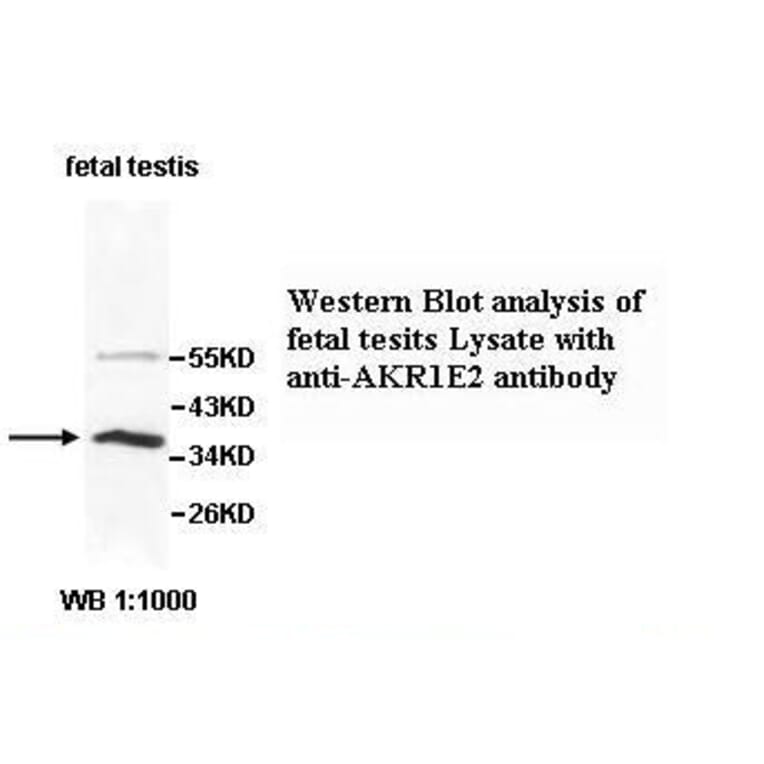 AKR1E2 Antibody from Signalway Antibody (39519) - Antibodies.com