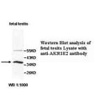 AKR1E2 Antibody from Signalway Antibody (39519) - Antibodies.com