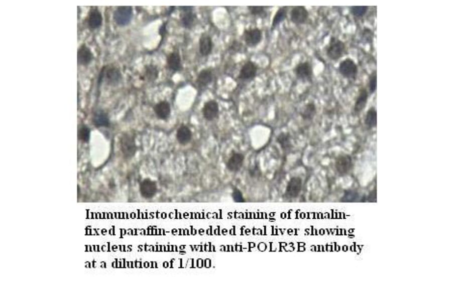 POLR3B Antibody from Signalway Antibody (39526) - Antibodies.com